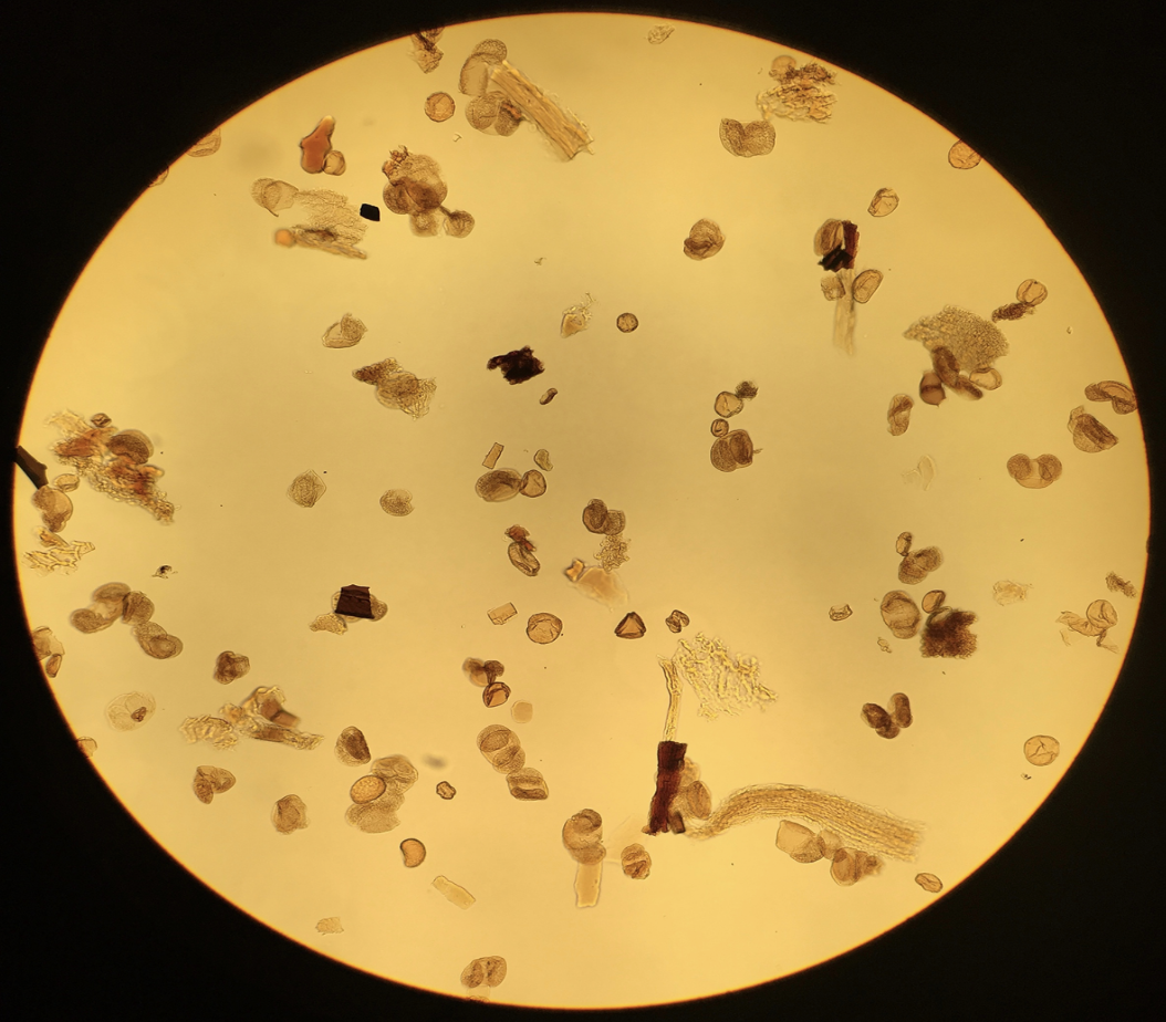 Pollen, our formidable foe, under a microscope.